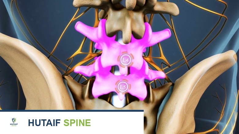 آلام أسفل الظهر لدى كبار السن الأسباب والعلاج مع الأستاذ الدكتور محمد هطيف في صنعاء