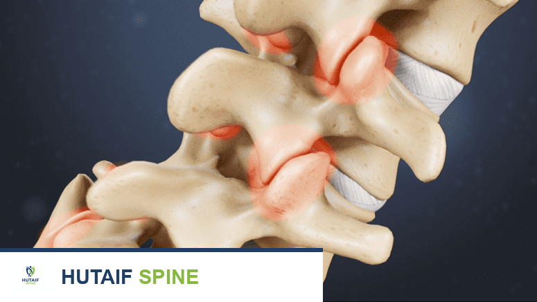آلام أسفل الظهر: دليل شامل للأسباب، الأعراض، التشخيص، والعلاج الفعال مع الأستاذ الدكتور محمد هطيف