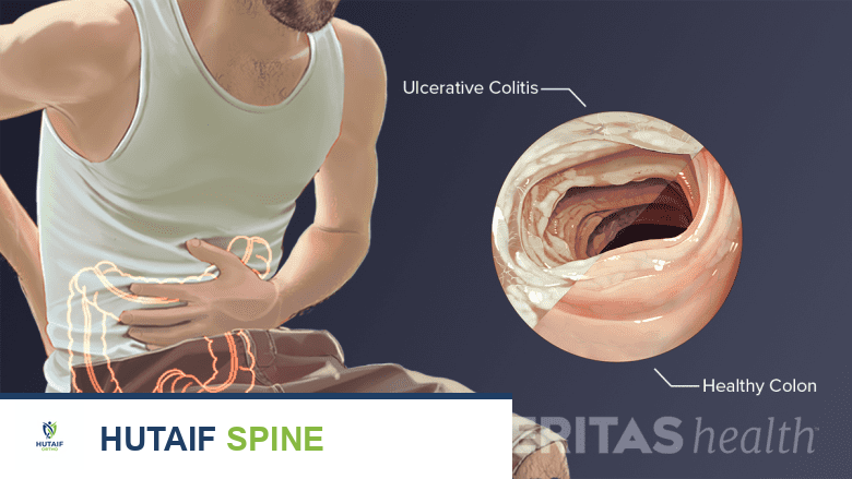 ألم أسفل الظهر الأيمن من الأعضاء الداخلية الأسباب والتشخيص والعلاج