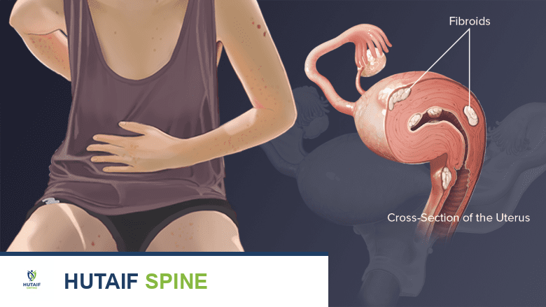 صورة توضيحية لـ ألم أسفل الظهر الأيمن من الأعضاء الداخلية الأسباب والتشخيص والعلاج