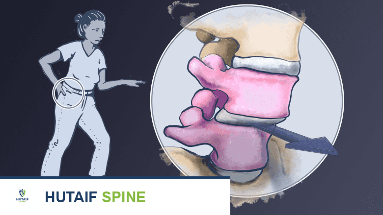 توضيح يظهر فقرة تنزلق فوق الأخرى.