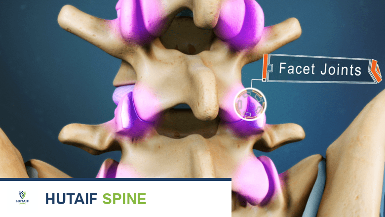 رسم توضيحي للعمود الفقري القطني مع إبراز المفاصل الوجهية.