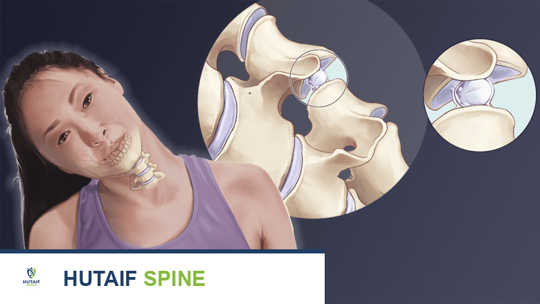 طقطقة الرقبة وطحنها: دليل شامل لأسبابها وأعراضها وعلاجها مع الأستاذ الدكتور محمد هطيف