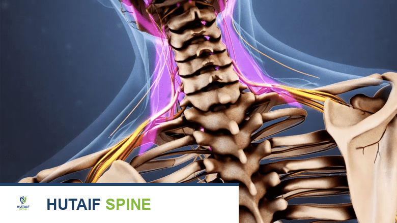 توضيح يظهر الرقبة باللون الوردي.