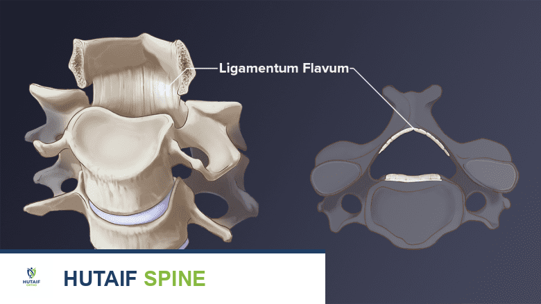 توضيح للأربطة الصفراء