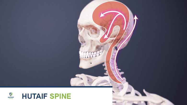 رسم توضيحي طبي يظهر الصداع العنقي.