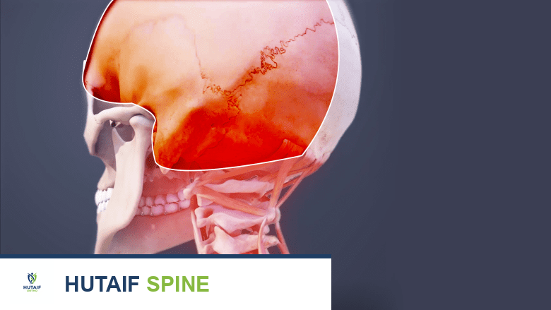صورة توضيحية للصداع النصفي تظهر الألم النابض في الرأس مع الغثيان والحساسية للضوء والصوت.