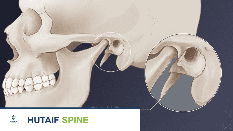 آلام الرقبة ومتلازمة إيغل: دليل شامل للمرضى مع الأستاذ الدكتور محمد هطيف