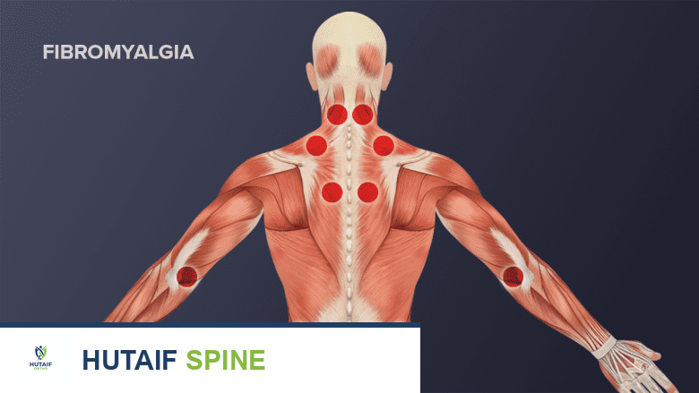 صورة توضيحية لـ آلام الرقبة والفيبروميالغيا: دليل شامل للأسباب، الأعراض، والحلول مع الأستاذ الدكتور محمد هطيف