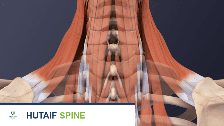صورة توضيحية لـ آلام الرقبة والفيبروميالغيا: دليل شامل للأسباب، الأعراض، والحلول مع الأستاذ الدكتور محمد هطيف