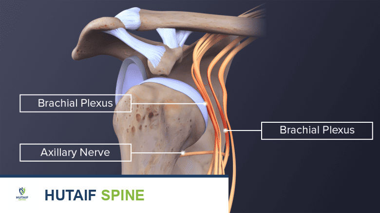 صورة توضيحية لـ آلام الرقبة ومتلازمة مخرج الصدر: دليلك الشامل للتشخيص والعلاج مع الأستاذ الدكتور محمد هطيف