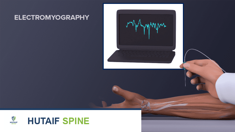 صورة طبية: آلام الرقبة ومتلازمة مخرج الصدر: دليلك الشامل للتشخيص والعلاج مع الأستاذ الدكتور محمد هطيف