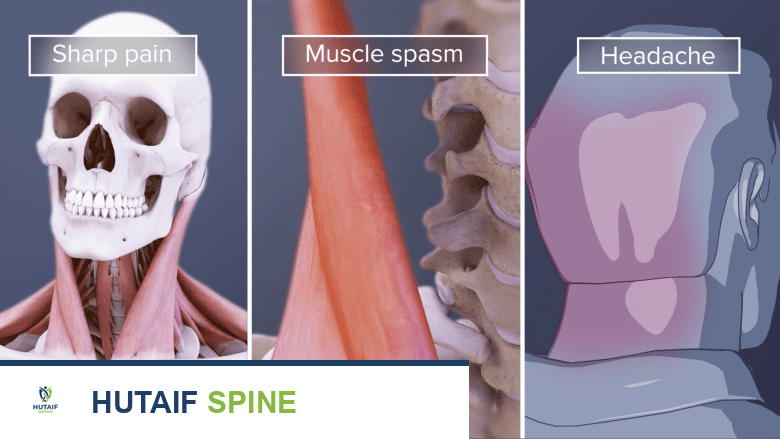 An illustration showing stiff neck muscle pain and haedache.