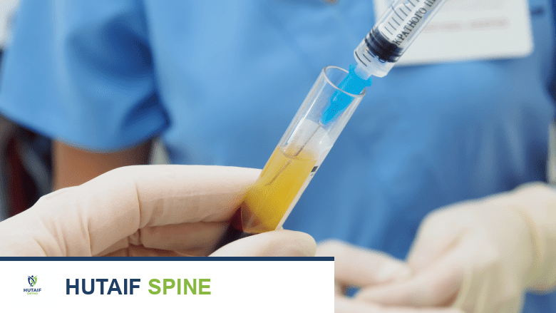 صورة توضيحية لـ التهاب العظم والنقي في العمود الفقري التشخيص والعلاج مع الأستاذ الدكتور محمد هطيف