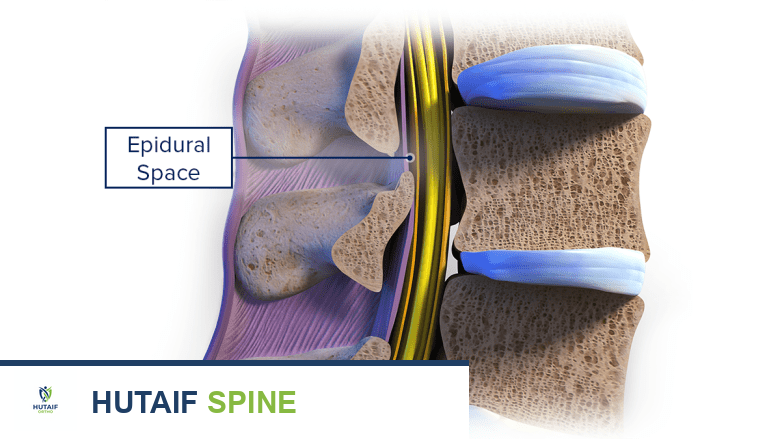 أعراض التهاب الفقرات العظمي: دليل شامل من الأستاذ الدكتور محمد هطيف