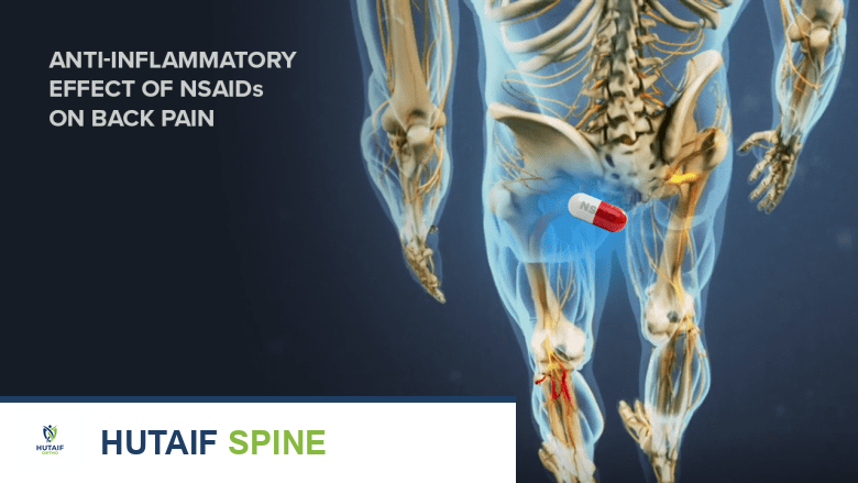 أدوية علاج خشونة القرص التنكسي: دليل شامل للمرضى مع الأستاذ الدكتور محمد هطيف