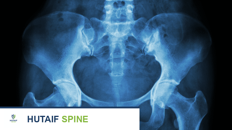 الطب الطبيعي وإعادة التأهيل: نهج شامل لتعزيز جودة الحياة في اليمن مع الأستاذ الدكتور محمد هطيف