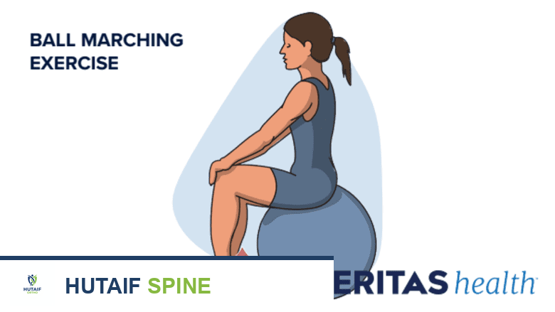 صورة توضيحية لـ العلاج الطبيعي بعد دمج الفقرات: دليل شامل للأسابيع 6 إلى 9 لتعافٍ مثالي مع الأستاذ الدكتور محمد هطيف