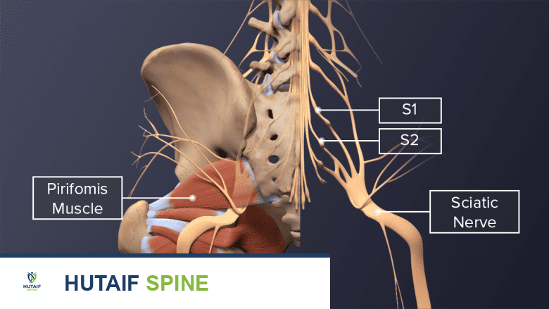 Posterior view of the buttocks labeling the piriformis muscle, S1, S2, and sciatic nerve.