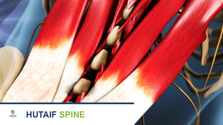 توضيح للعمود الفقري لدى الكبار مع تظليل العضلات باللون الأحمر.