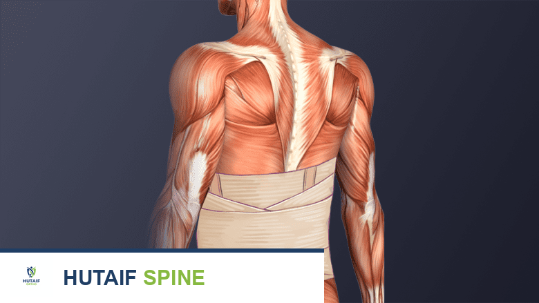 صورة توضيحية لـ التعافي الشامل بعد جراحة دمج الفقرات المتعددة: دليل الأستاذ الدكتور محمد هطيف