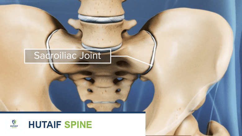 صورة توضيحية لـ تشريح المفصل العجزي الحرقفي: دليلك الشامل من الأستاذ الدكتور محمد هطيف