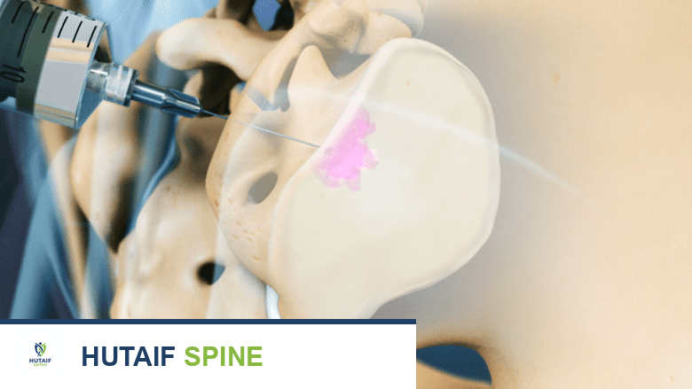 توضيح طبي: حقن المفصل العجزي الحرقفي: المخاطر، نسب النجاح، والنتائج طويلة الأمد مع الأستاذ الدكتور محمد هطيف