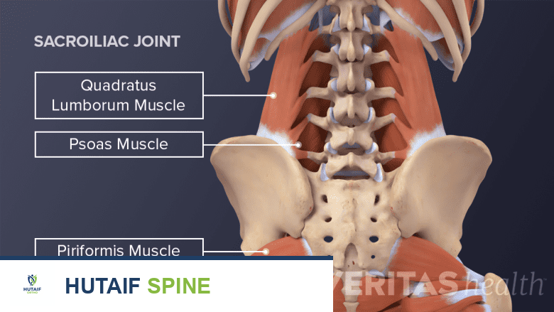 عرض خلفي للجذع يبرز العضلة المربعة القطنية، العضلة القطنية، والعضلة الكمثرية.