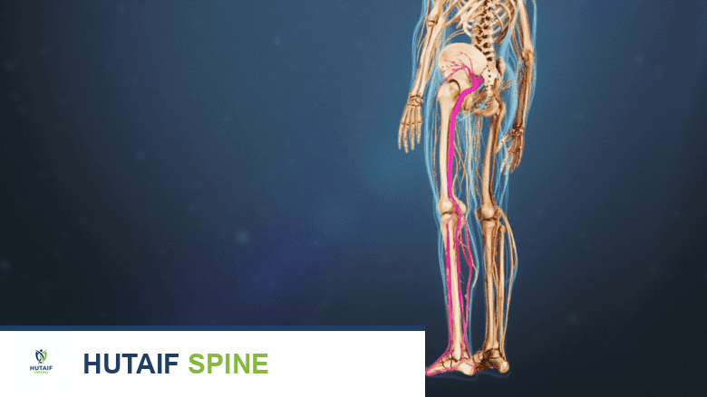 ألم الأعصاب في الساق