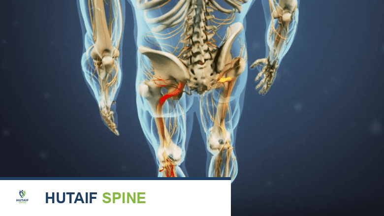 العصب الوركي وتفرعاته في كلا الساقين.