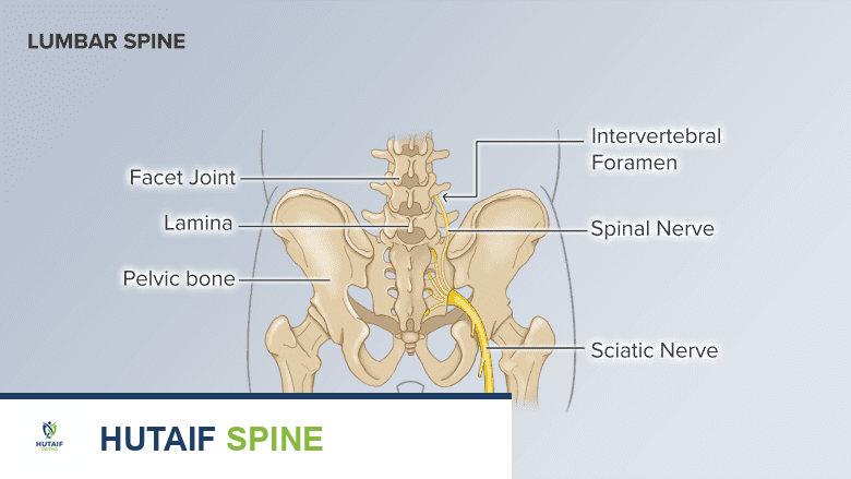 جراحة عرق النسا: دليل شامل لخيارات العلاج والتعافي مع الأستاذ الدكتور محمد هطيف في صنعاء