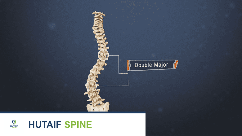الجنف انحناء العمود الفقري كل ما تحتاج لمعرفته من الأستاذ الدكتور محمد هطيف