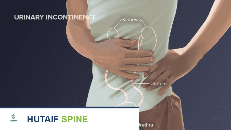 رجل يمسك بطنه ومخطط للكلى والحالبين والإحليل.