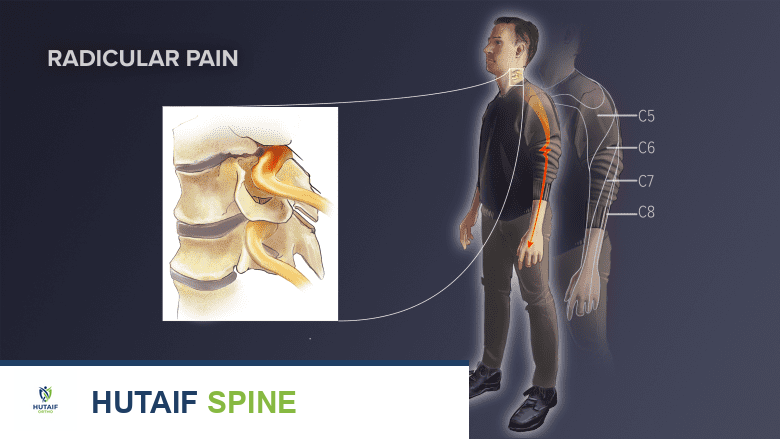 صورة توضيحية لـ الحبل الشوكي وجذور الأعصاب الشوكية: دليل شامل لصحة عمودك الفقري مع الأستاذ الدكتور محمد هطيف
