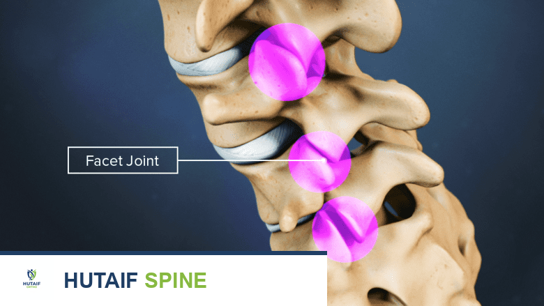 توضيح طبي: أخطر حالات الحبل الشوكي التي تسبب أعراض عرق النسا: دليل شامل من الأستاذ الدكتور محمد هطيف