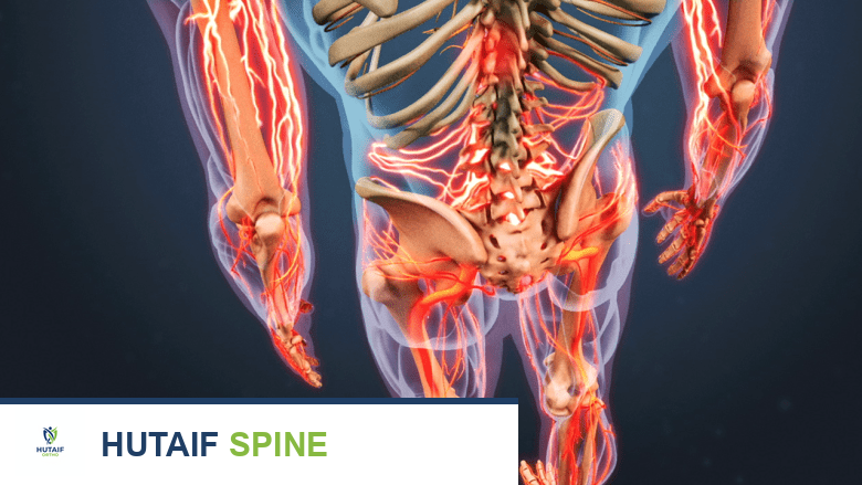 رسم ثلاثي الأبعاد خلفي للأعصاب في الظهر والأطراف باللون الأحمر.