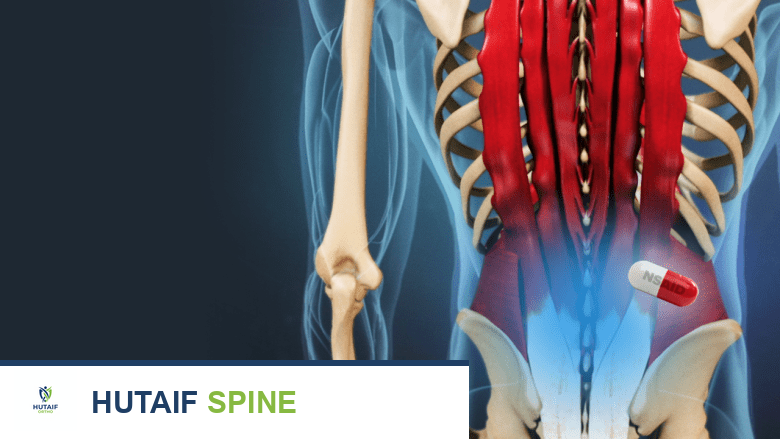 صورة توضيحية لـ مخاطر ومضاعفات عملية دمج الفقرات: دليل شامل للمرضى