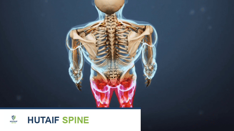 صورة توضيحية لـ انحلال الفقار والانزلاق الفقاري: دليلك الشامل مع الأستاذ الدكتور محمد هطيف