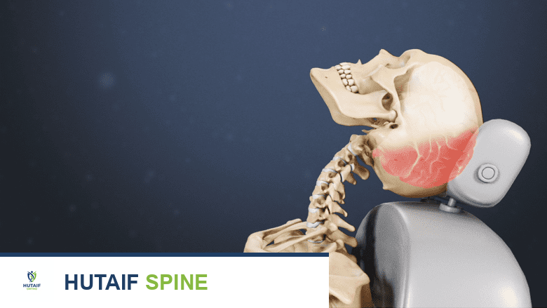 صورة توضيحية طبية تُظهر إصابة الرقبة بالصدمة أو "الوهقة".