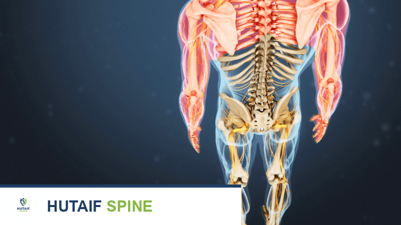 صورة توضيحية لـ تضيق القناة الشوكية المركزية الأعراض الأسباب والخيارات العلاجية مع الأستاذ الدكتور محمد هطيف