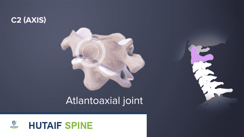عرض ثلاثي الأبعاد للمفصل الأطلسي المحوري كما يرى من الجانب، بجانب صورة ظلية للعمود الفقري العنقي.