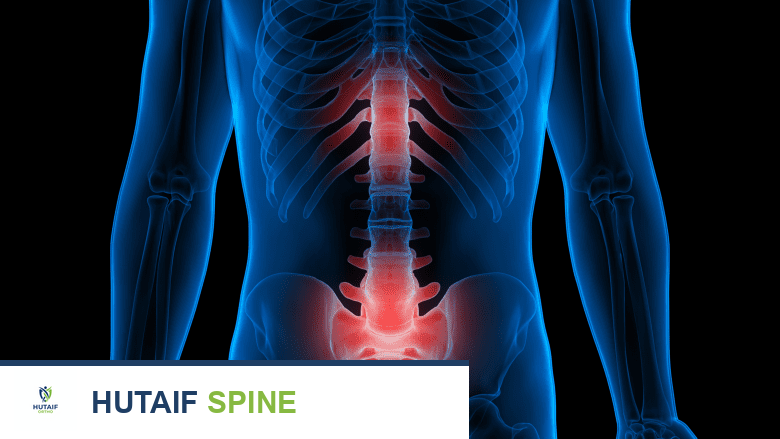 صورة توضيحية لـ حقيقة طقطقة الظهر وطحن الفقرات: متى تكون طبيعية ومتى تستدعي القلق؟ دليل شامل من الأستاذ الدكتور محمد هطيف في صنعاء