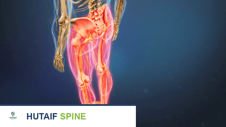 الانزلاق الغضروفي الصدري: الأعراض، الأسباب، والحلول العلاجية مع الأستاذ الدكتور محمد هطيف