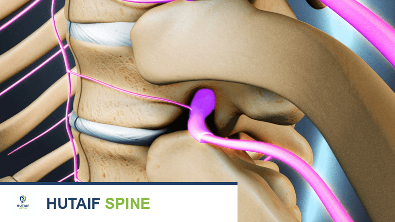 منظر ثلاثي الأبعاد سهمي للعمود الفقري الصدري مع الأعصاب باللون البنفسجي.