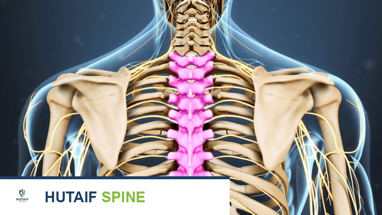 آلام الظهر العلوية والعمود الفقري الصدري: دليل شامل للتشخيص والعلاج مع الأستاذ الدكتور محمد هطيف في صنعاء