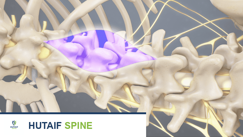 منظر خلفي لموقع شق أسفل الظهر.