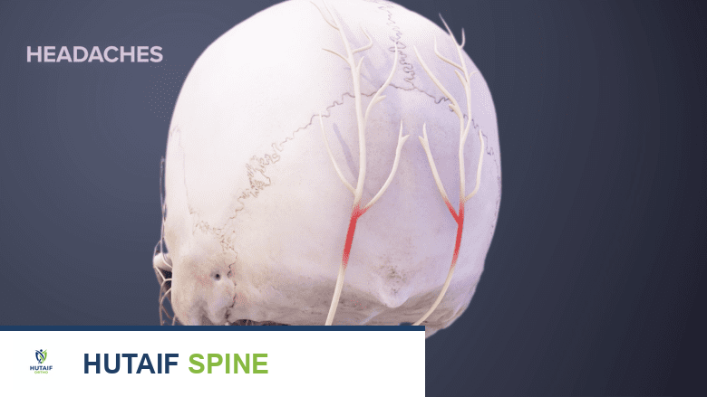 علاج الألم المزمن والاكتئاب المصاحب لمرض القرص التنكسي: دليل شامل من الأستاذ الدكتور محمد هطيف
