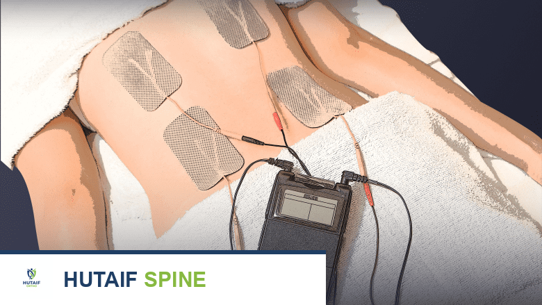 شخص يتلقى علاج TENS في أسفل الظهر.