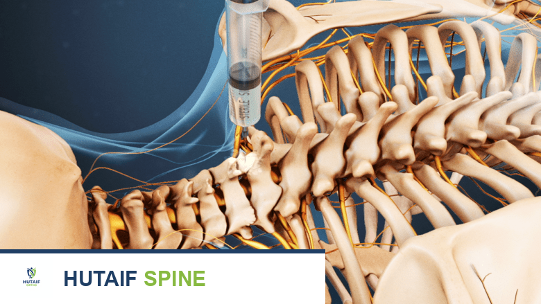 علاج آلام الرقبة: دليل شامل من الأستاذ الدكتور محمد هطيف