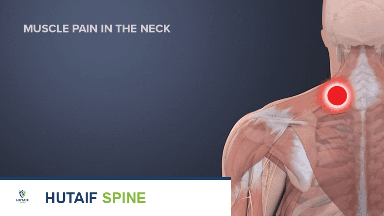 علاج الصداع الرقبي المنشأ: دليل شامل من الأستاذ الدكتور محمد هطيف في صنعاء